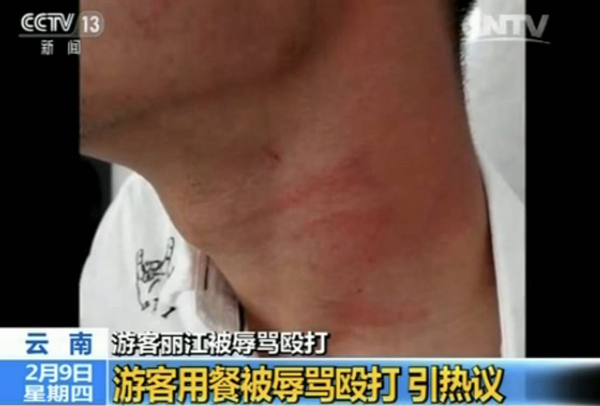 游客麗江就餐被辱罵毆打 真相到底是什么？