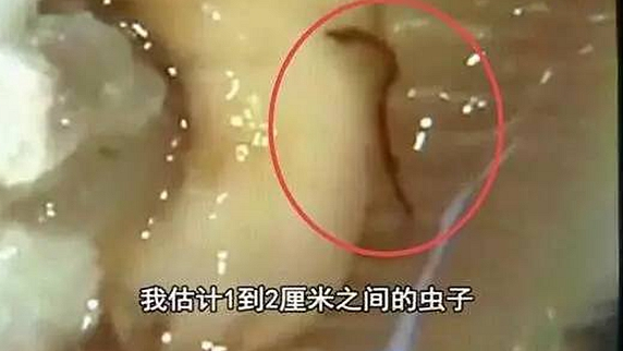 一只生蠔引起的冤案，觸動了餐飲人的“麻木神經”